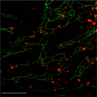 Mitofusins are required on adjacent mitochondria to mediate membrane fusion.