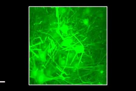 A new vector for gene transfer across the blood brain barrier