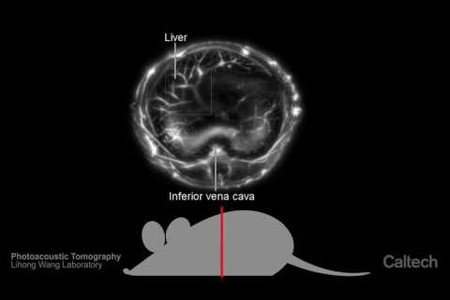 Photoacoustic Tomography - Lihong Wang Lab