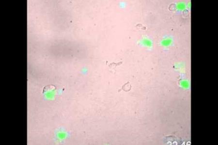 Cells Expressing PU.1 with GFP