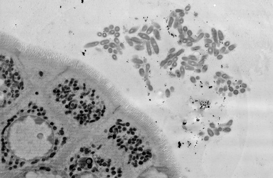 An electron microscopy image of a section of the mouse gut, showing B. fragilis aggregating close to the epithelial cells that make up the lining of the gut.