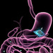 illustration of chip in gut