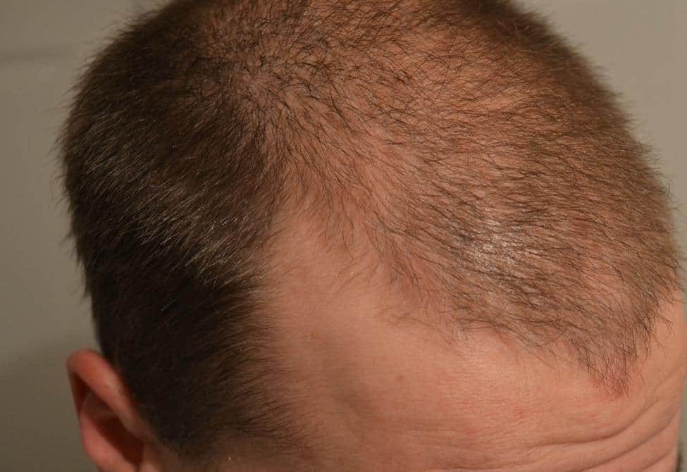 FJ RELIABILITY MID LIFE CRISIS visual data 2