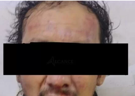 Otro presunto asaltante golpeado en Amozoc.