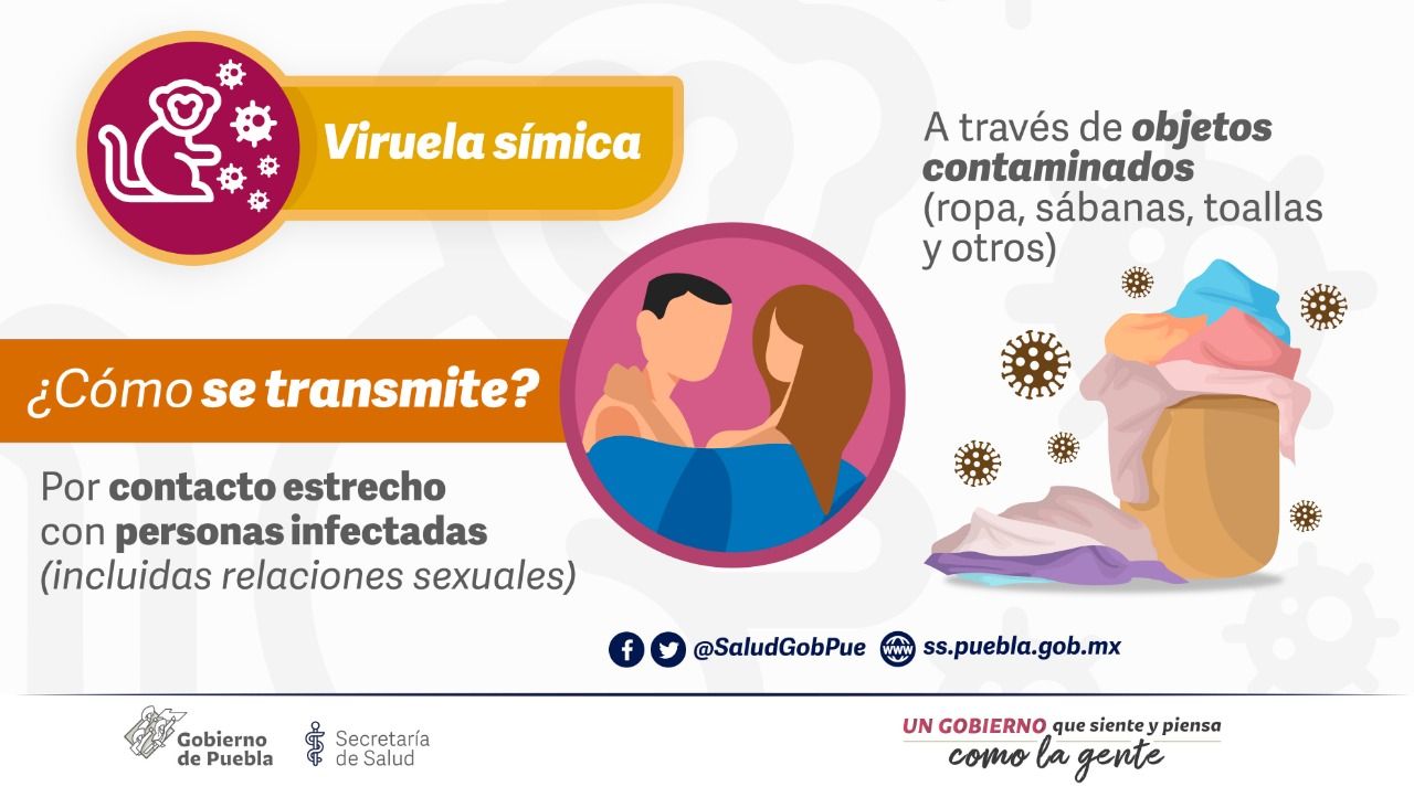 Reportan 2 primeros casos de Viruela Símica en Puebla