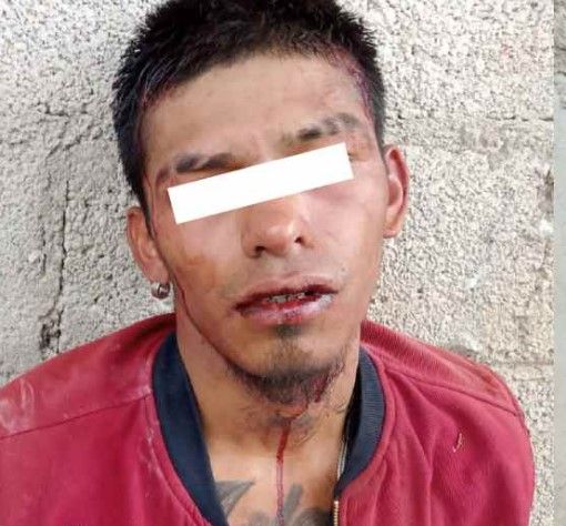 "Por falta de pruebas" dejan el libertad a asaltantes que machetearon a hombre para robarlo.