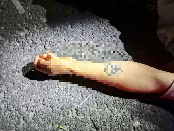 Muere hombre atropellado en inmediaciones de Amozoc.