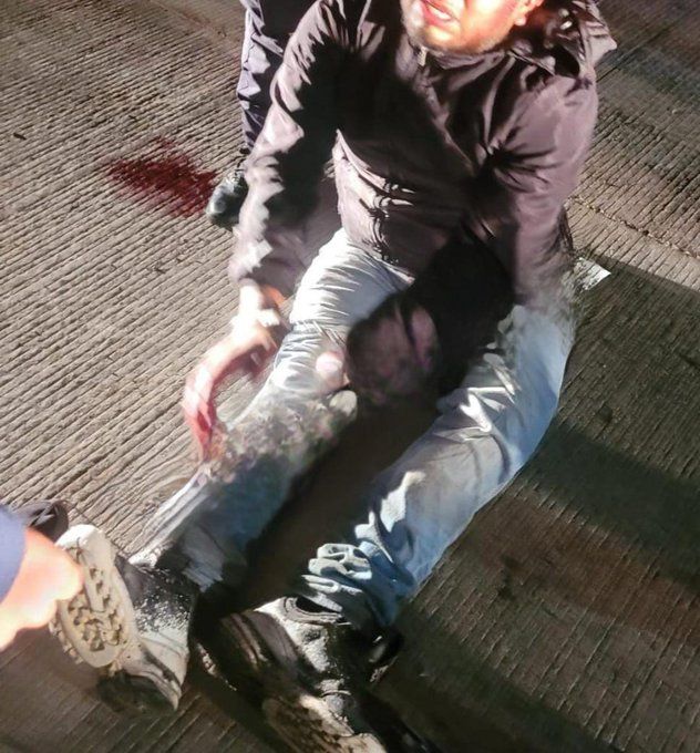 "La Torpeza Criminal: Un Ladrón se Dispara a Sí Mismo en un Robo en Amozoc"