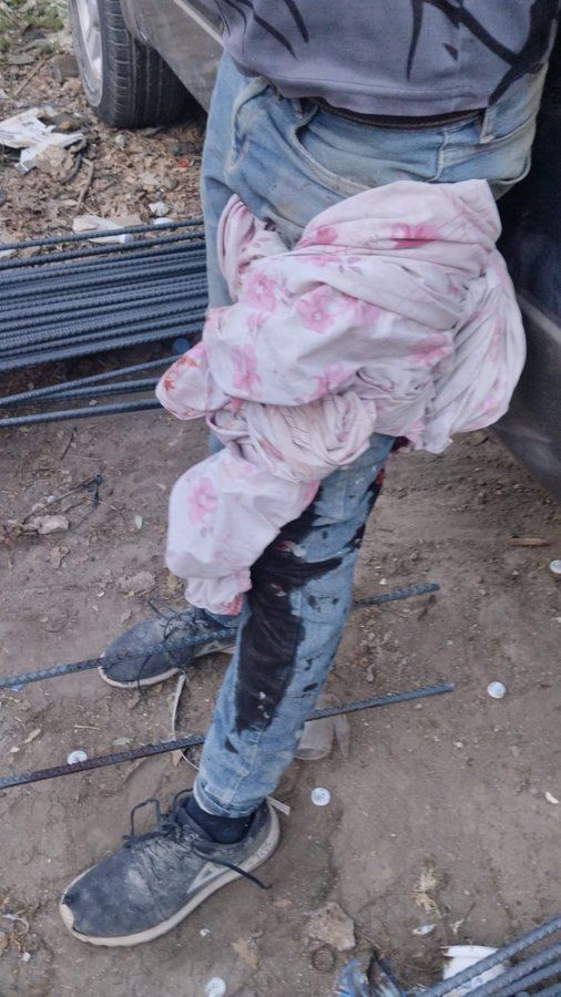 Violencia policial en Amozoc: Policías golpean y balean a trabajador del Metrobús