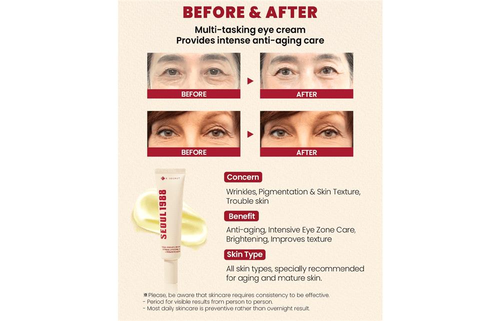 كي سيكريت سيول 1988 ريتينال ليبوسوم 4 كريم للهالات وتجاعيد تحت العين 30ml