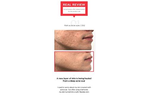 مجموعة الحلزون الاسود لتجديد البشرة من سوم باي مي  4 قطع