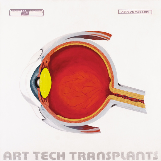 HTBT Art Tech Transplants; Active yellow