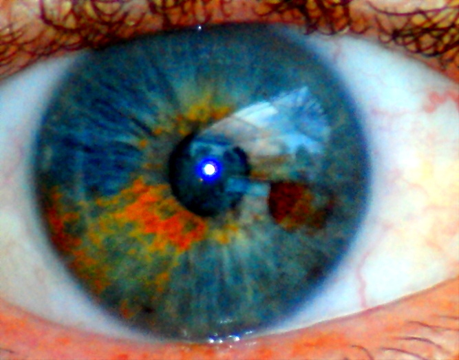 eye