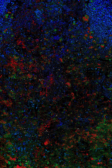 Depth