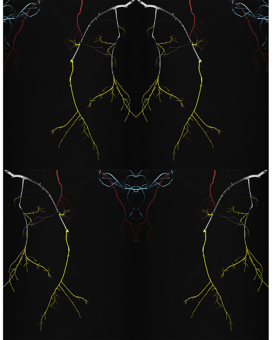 Almost Lightning_Collage5 by MARK REINERS