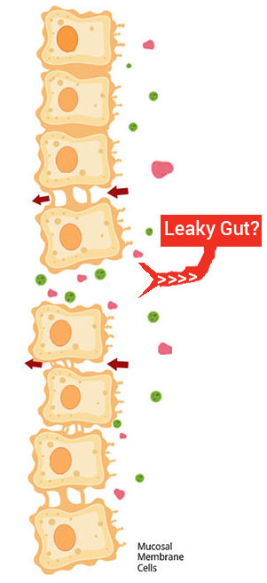 Leaky gut syndrome and your Health