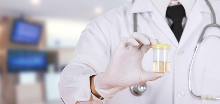 doctor-holding-pee