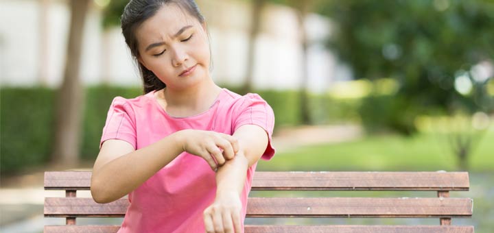 Eczema: What It Is And The Best Natural Remedies