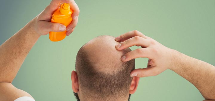 Glatze-Mann-Haarspray