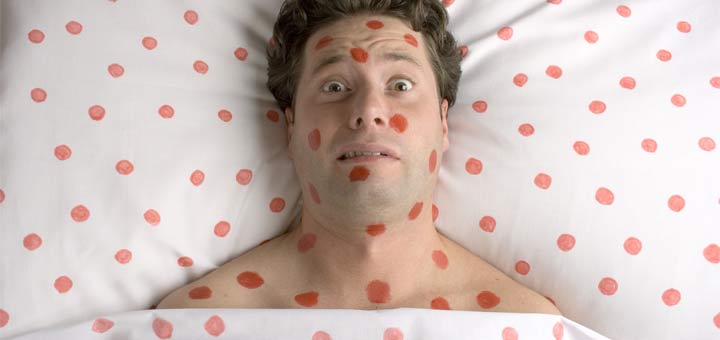 worried-man-measles-in-bed
