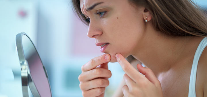 DIY Spot Treatment Care For Blemishes