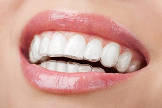 Clear teeth aligner