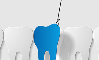 Cartoon of tooth being pulled