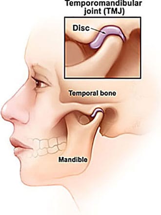 Diagram of facial parts involved in TMJ