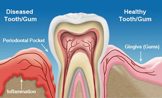 Diagram of root canal
