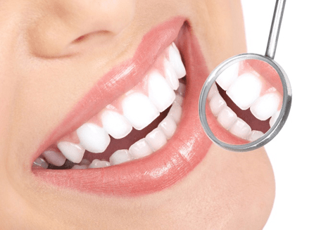 Preventative dentistry San Jose