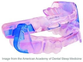 Oral appliance