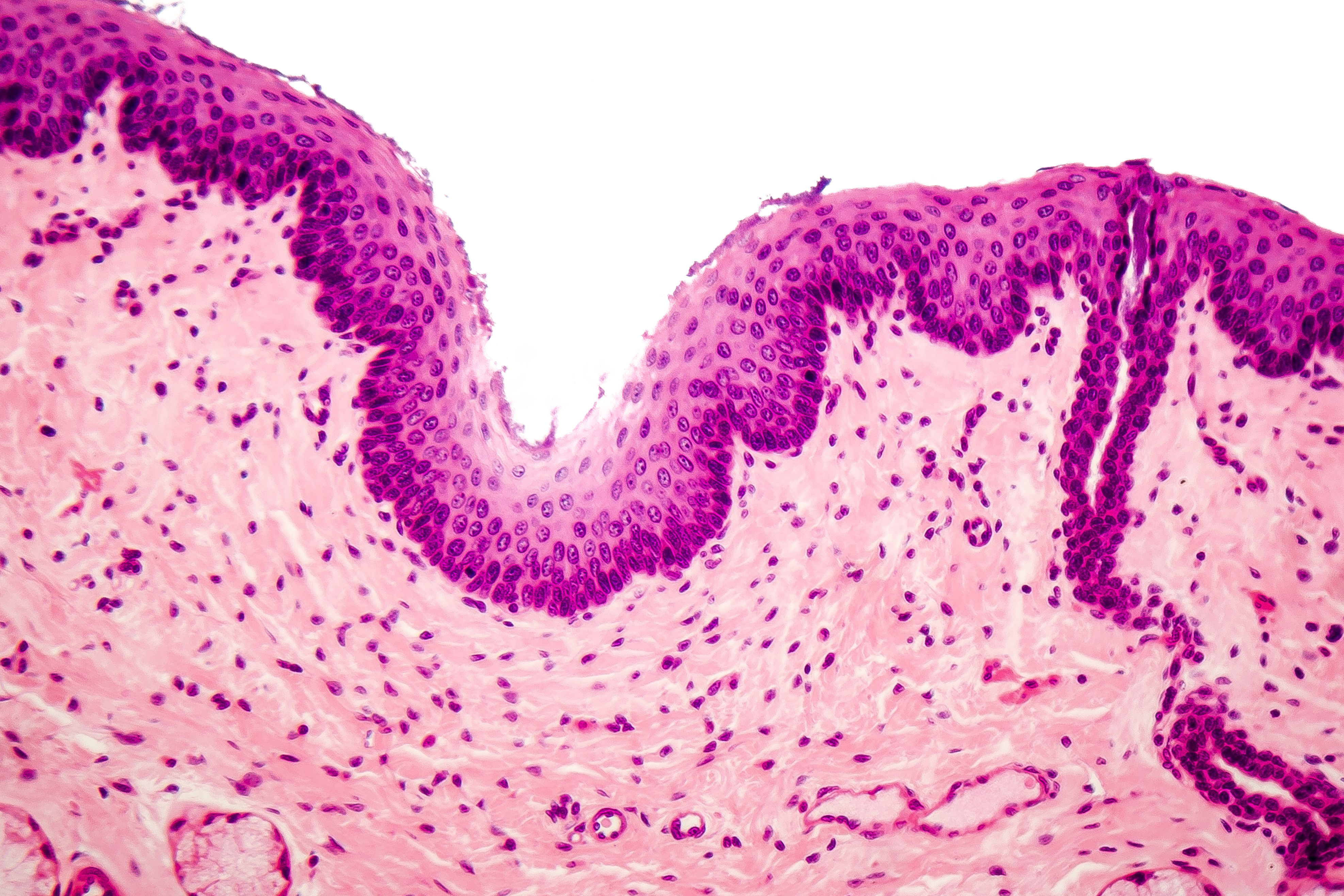 What Are The Differences Of Simple And Stratified Tissue