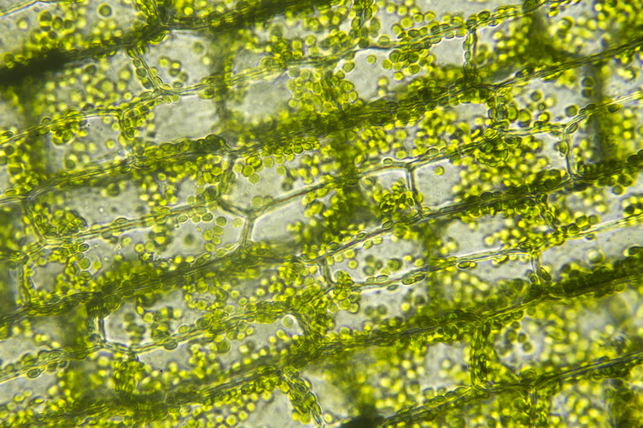 elodea cells under a microscope