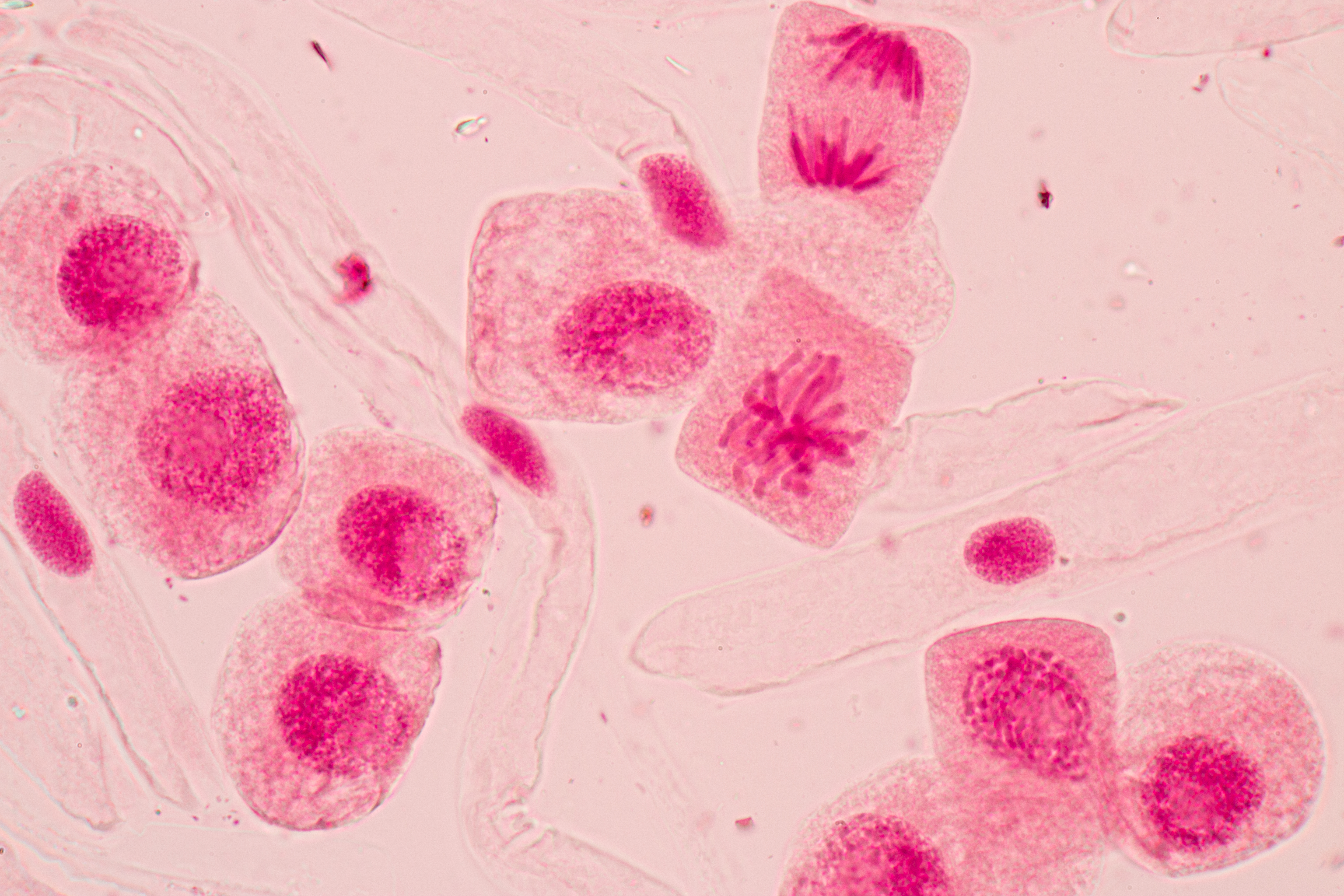 stages of mitosis under microscope