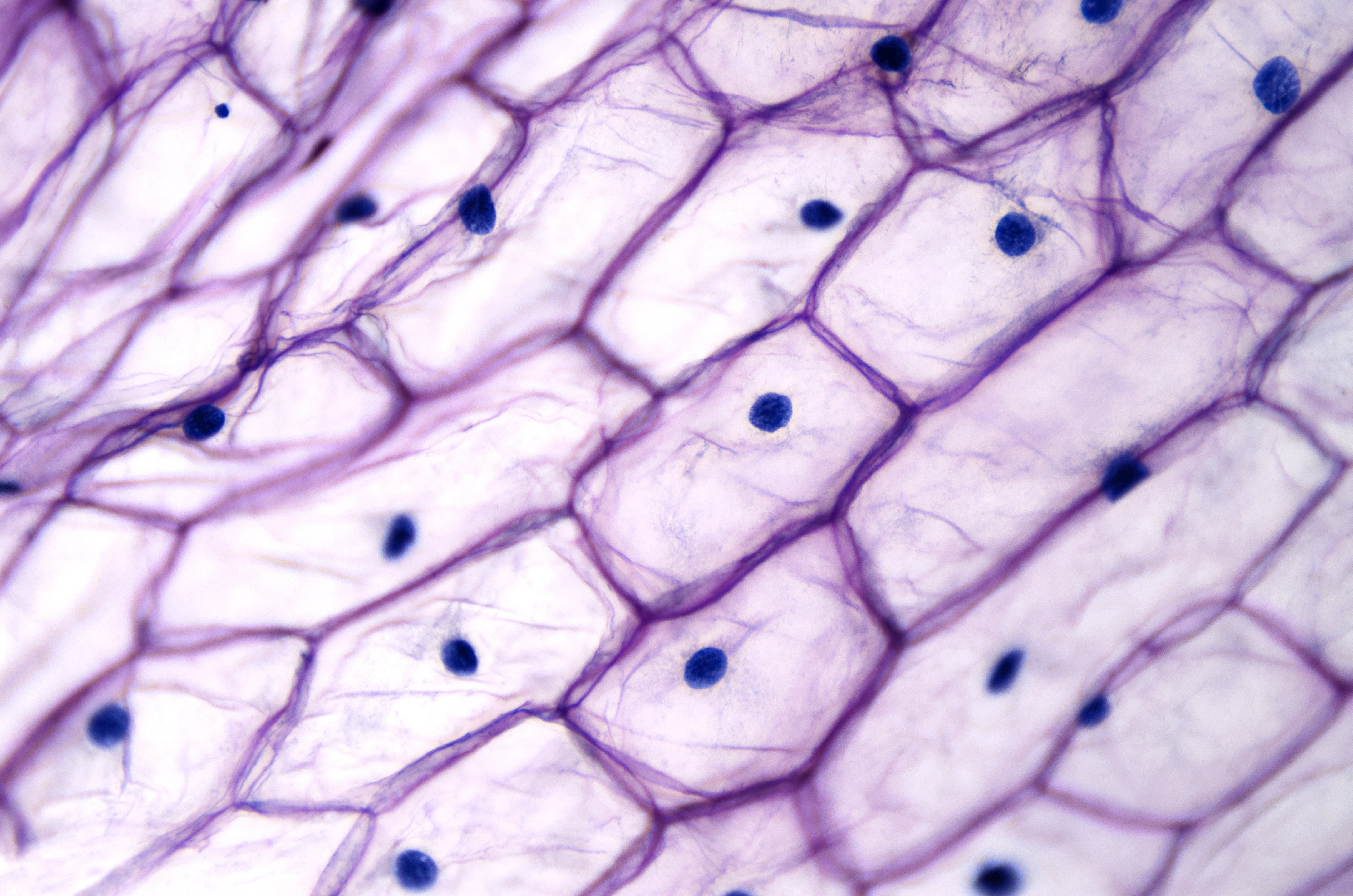 Vacuoles Definition Function Structure