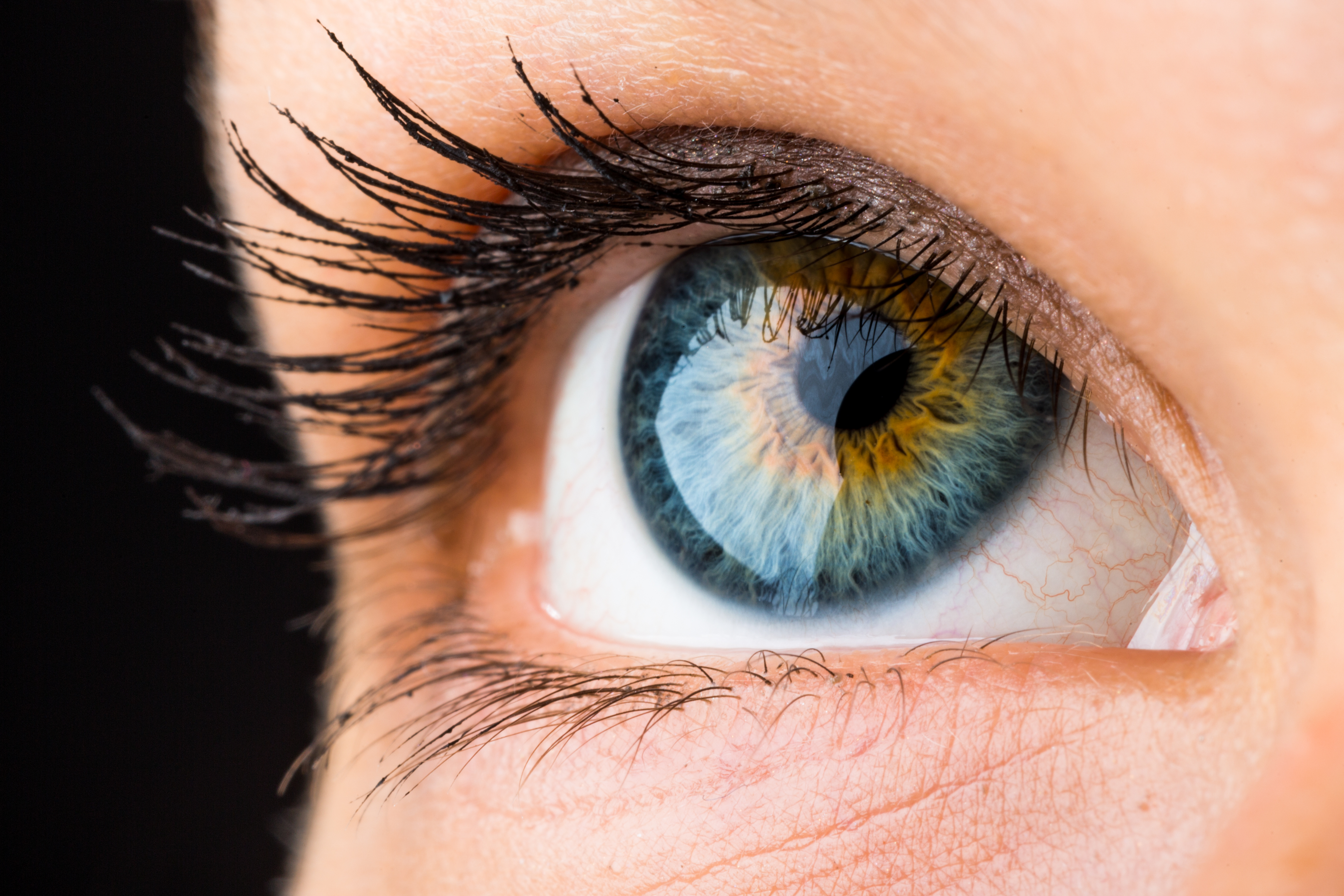 Causes Of Flashes In The Outer Corner Of The Eye