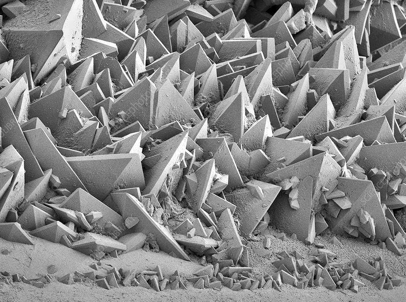 Kidney stone under electron microscope photo