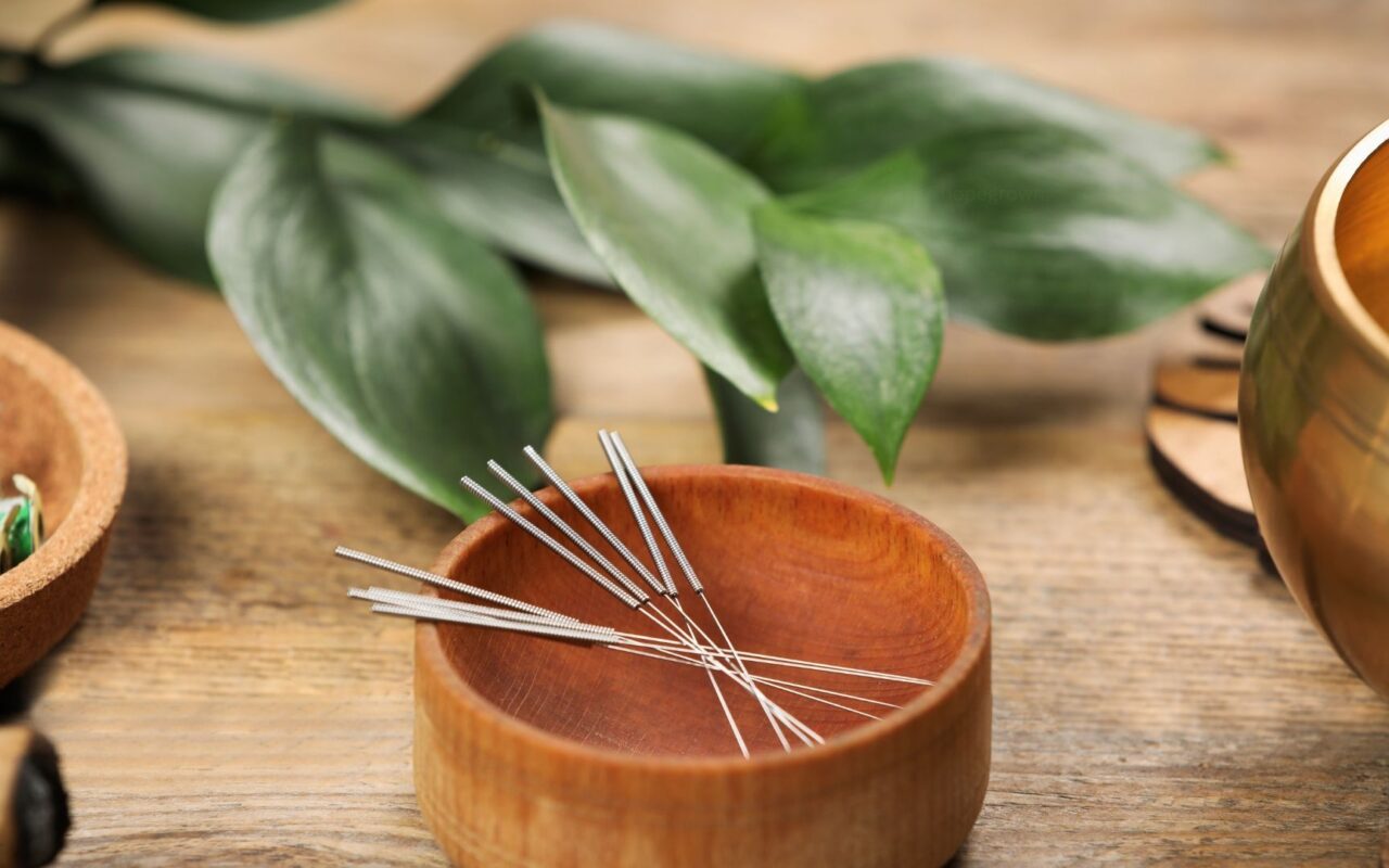 Curious About What to Expect at Acupuncture Treatments? Start Here
