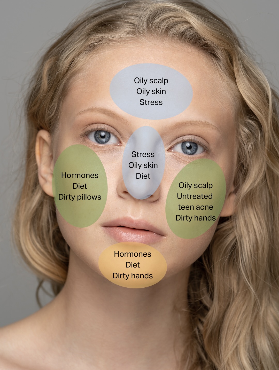 Face mapping your acne and what it means on your face revealed