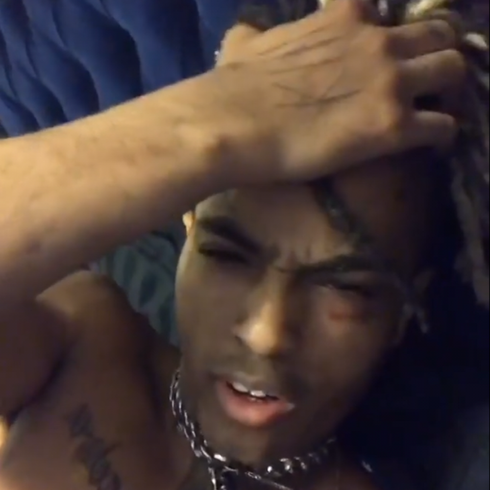 Get Xxxtentacion Responds To Domestic Abuse Allegations In Series Of For iPhone Get Wallpaper Xxxtentacion Responds To Domestic Abuse Allegations In Series Of Free HD