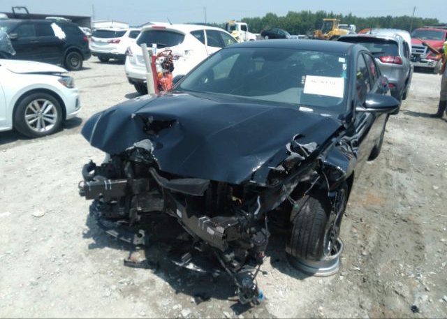 2021 HYUNDAI ELANTRA(VIN: KMHLS4AG9MU180261