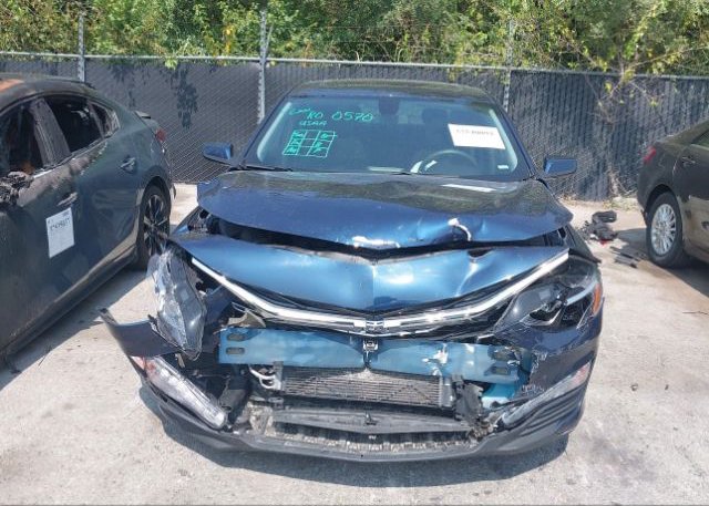 2022 CHEVROLET MALIBU(VIN: 1G1ZD5ST6NF152281