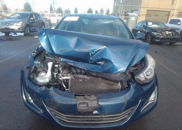KMHDH4AH0EU066050 2014 HYUNDAI ELANTRA