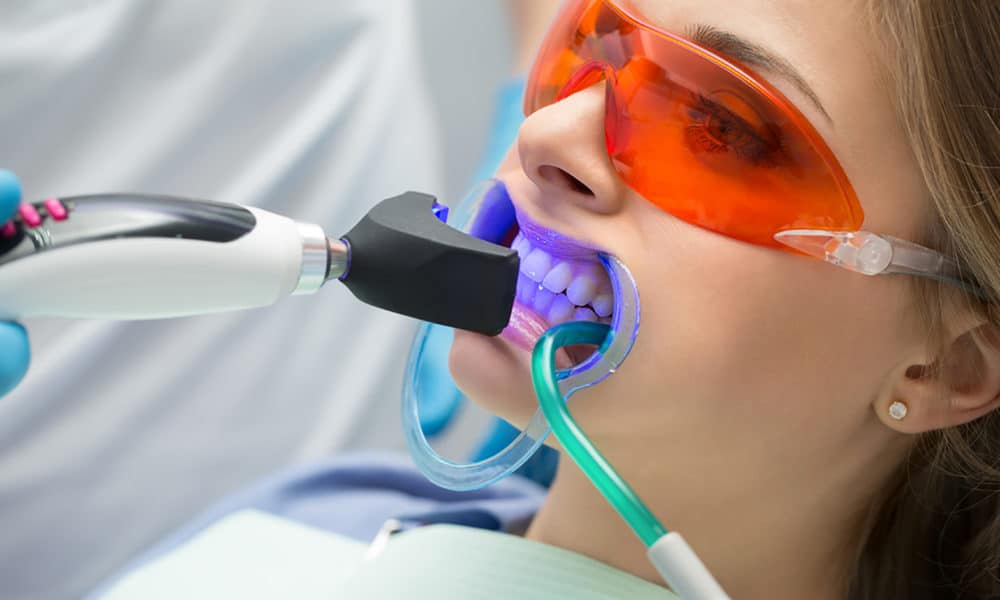 Why Teeth Whitening Is So Popular These Days why teeth whitening is so popular main image 1000x600 - Why Teeth Whitening Is So Popular These Days