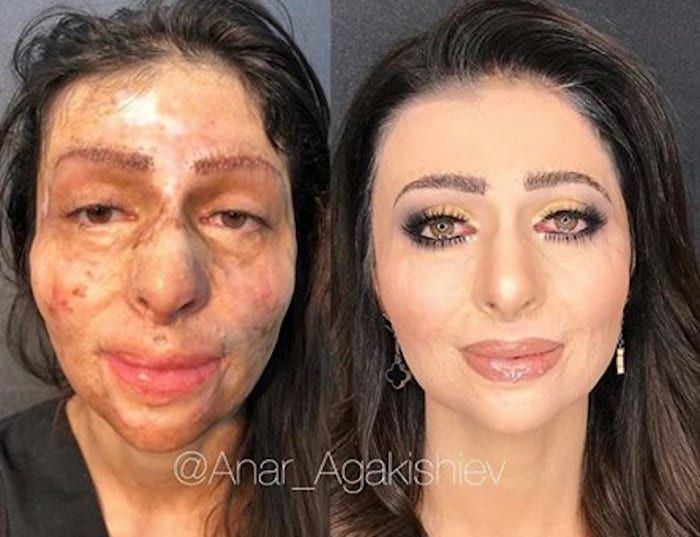 beauty transformations by anar agakishie